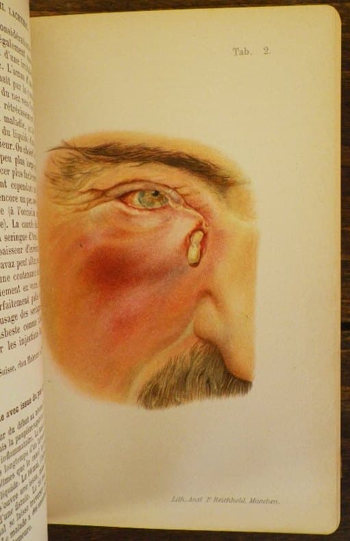 Extrait des lois concernant l'administration de la santé dans l'isle de Corse et dépendances, et arrêtés du Conseiller d'Etat, administrateur général des départemens du Golo, et du Liamone, y relatifs